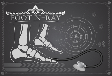 Foot x-rayのイラスト素材