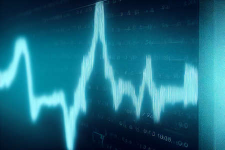 Electrocardiogram, EKG, heart rate monitor showing a specific illness in hospital room for checking...