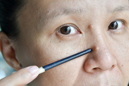 Close up of asian woman point mole on her face and nose, prepared to removeの写真素材
