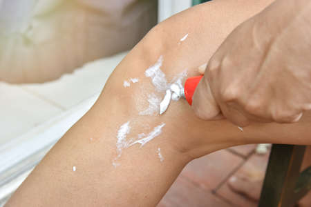 woman leg apply the balm on injury knee, pain from sport woman use a cream to relief painfulの写真素材