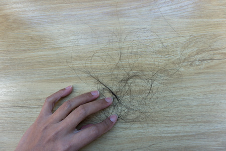 Hair loss problems.の写真素材