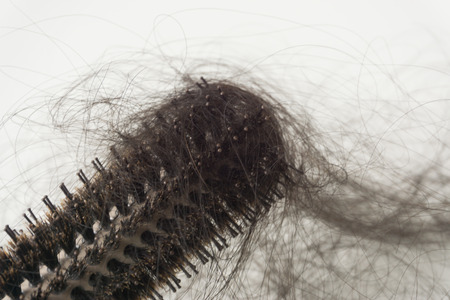 Hair loss problem, Comb and hair.の写真素材