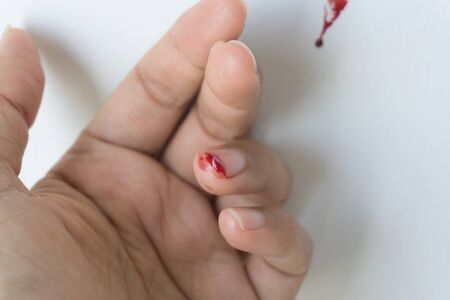 Red blood from finger, Accidents always happen.の写真素材