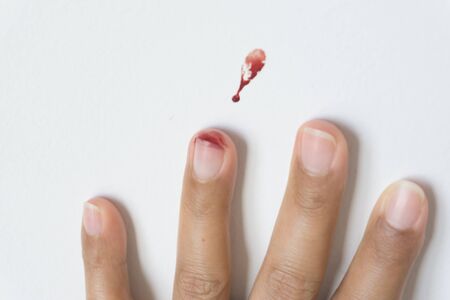 Red blood from finger on white background.の写真素材