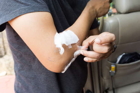 Young man with a wound on his arm.の写真素材