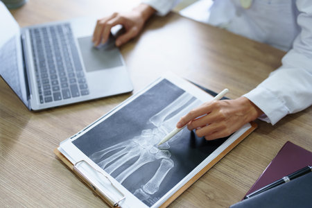Asian female doctor is analyzing patient data from x-ray film and using computer before preparing...