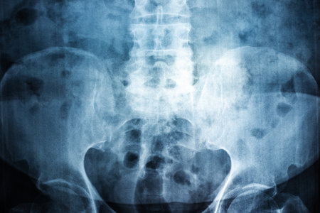 Film X-ray of spine a person, Film grain styleの写真素材