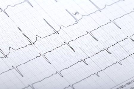 electrocardiogramの写真素材