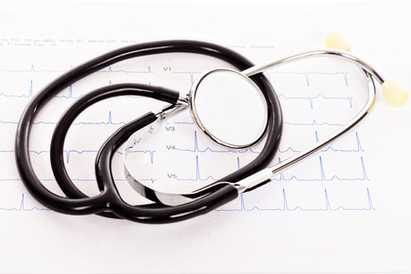 Stethoscope on an electrocardiogram (ECG) chart の写真素材