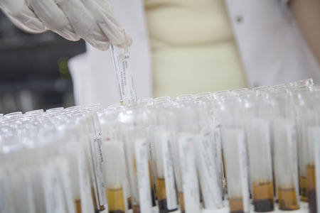 serum analysis