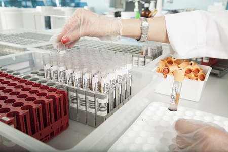 serum analysis
