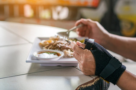 Hands of woman with thumb spica finger splint uses spoon and fork  to eat. Woman uses wrist support...