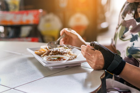 Hands of woman with thumb spica finger splint uses spoon and fork  to eat. Woman uses wrist support brace and have a meal. Hand in cast. female hands with orthosis. Injured hand of woman eating food.の写真素材