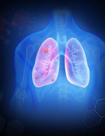 Human lungs infected by virus and bacteria. 3d illustration. Lungs Anatomy.の写真素材