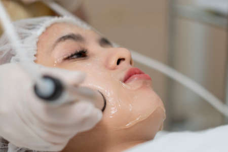 Close up the dermatologist apply the High intensity focus ultrasound to the woman face for the...