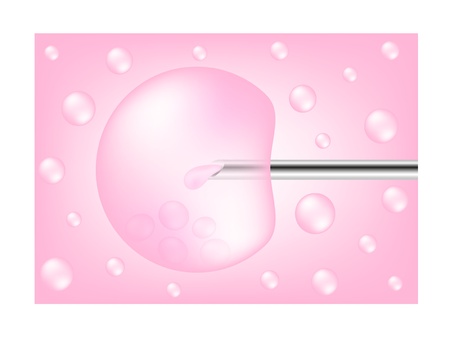 In vitro fertilization processのイラスト素材