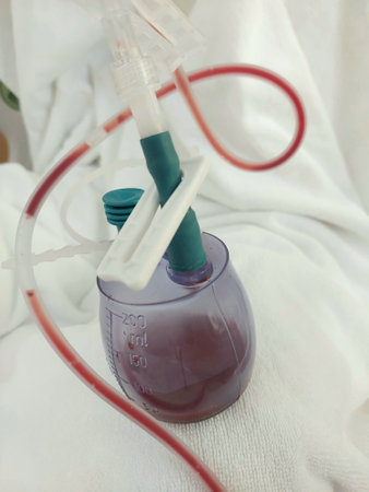 Radivac drain with surgical blood in hospitalの写真素材
