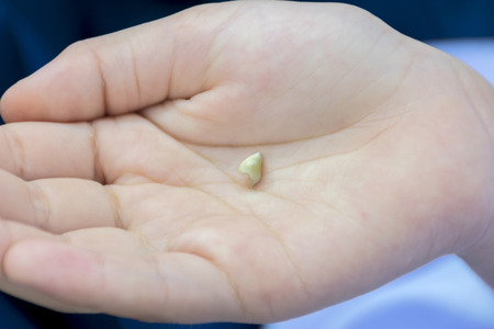 Showing baby tooth first Fall out,Put on the palm,There are changes in the way that development.