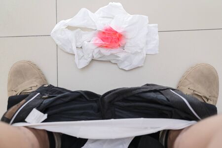 Hemorrhoids concept. An Asian man is sitting on a toilet, Tissue paper is placed on the bathroom...