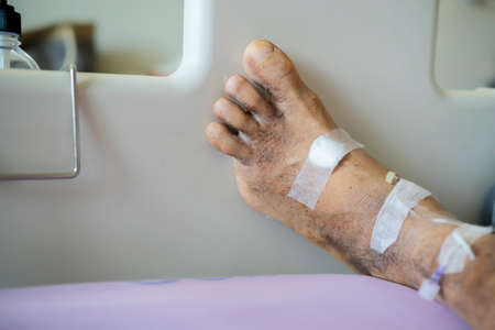 Diabetic patients were cut off the little finger. Recuperate at the hospital tryingの写真素材