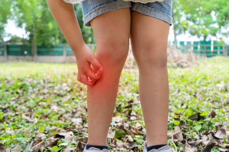 Asian girl has allergies with mosquitoes bite and itching her leg. Repellent, Dengue virus, Yellow fever, West nile, Malaria, Diseases Spread by Mosquitoes conceptの写真素材