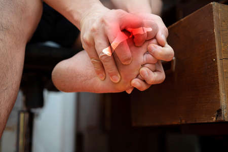 Man with painful and inflamed gout on his foot around the big toe area.の写真素材