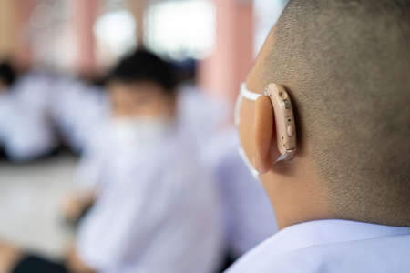child with hearing aid The boy assumed that the hearing aidの写真素材