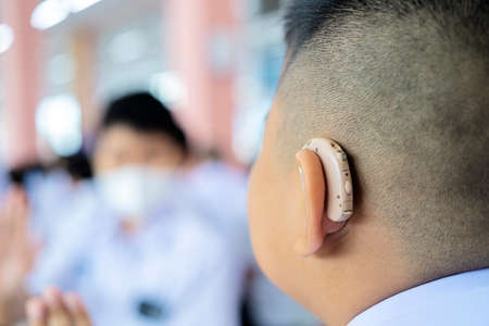 Little boy with hearing aid, closeup, using a hearing aid concept.の写真素材