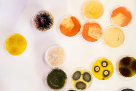 Culture of bacteria in petri dishの写真素材