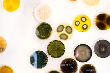 Culture of bacteria in petri dishの写真素材