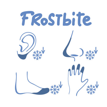 Frostbite icons set. Outline set of frostbite vector icons for web design isolated on white background.のイラスト素材