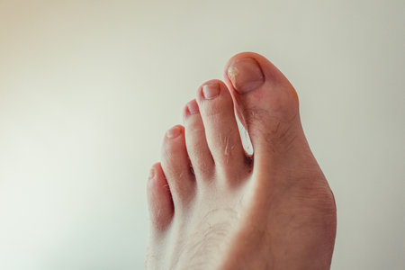 Ugly feet with a broken nail and hairy with big toe.の写真素材