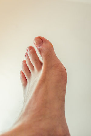 Ugly feet with a broken nail and hairy with big toe.の写真素材