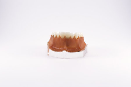 Model of human jaw with teeth and implants