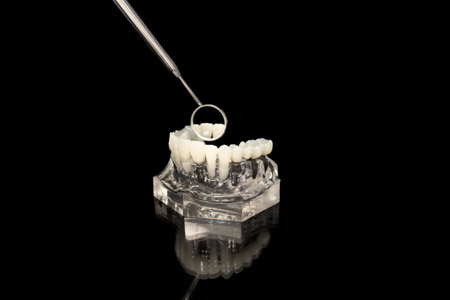 Glass jaw model with implanted dentures, dental mirror and probe on black background.