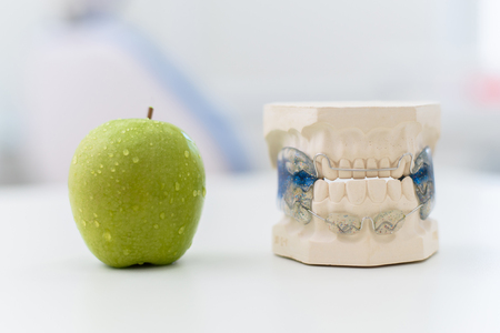 ceramic jaws with a clasp lie with an apple