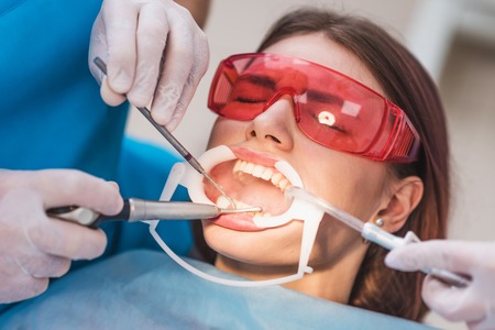 doctor performs the procedure for cleaning teethの写真素材