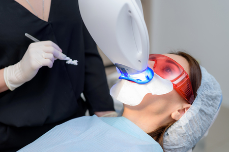 the girl undergoes the procedure of teeth whitening with the help of ultraviolet lampの写真素材