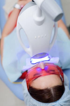 the girl undergoes the procedure of teeth whitening with the help of ultraviolet lampの写真素材