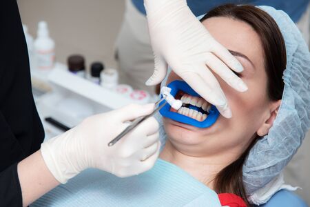 there is a preparation of the oral cavity to bleaching with the help of an ultraviolet lamp....