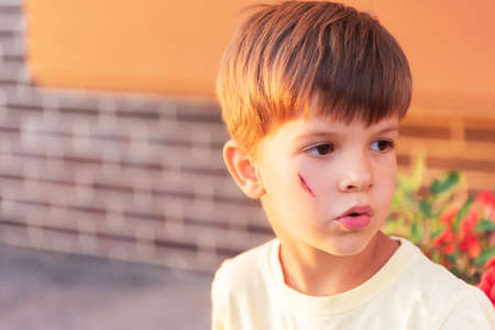 Portrait of a beautiful child with a bruise on his faceの写真素材