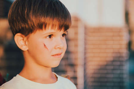 Portrait of a beautiful child with a scar on his faceの写真素材