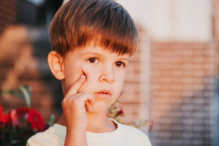 Portrait of a beautiful child with a scar on his faceの写真素材