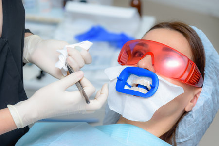 there is a preparation of the oral cavity to bleaching with the help of an ultraviolet lamp. close-upの写真素材