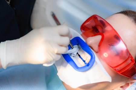 there is a preparation of the oral cavity to bleaching with the help of an ultraviolet lamp. close-upの写真素材