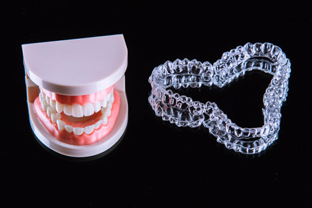 Close-up. Transparent aligners for artificial jaw teeth lie on a mirror on a black backgroundの写真素材