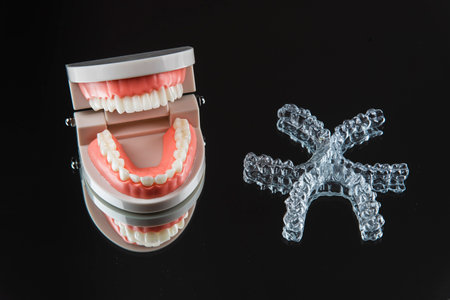 Close-up. Transparent aligners for artificial jaw teeth lie on a mirror on a black backgroundの写真素材