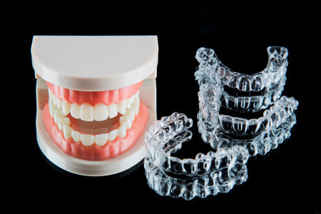 Close-up. Transparent aligners for artificial jaw teeth lie on a mirror on a black background
