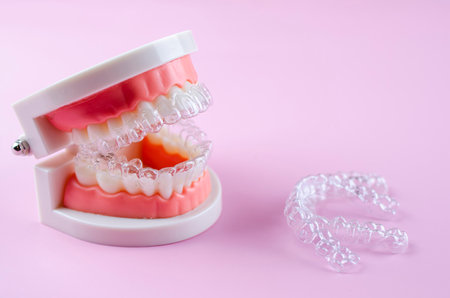 Invisible and removable aligners for teeth alignment on a pink backgroundの写真素材