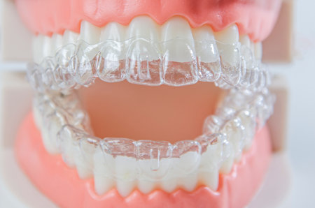 Close-up. Transparent aligners for artificial jaw teeth.の写真素材